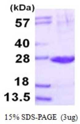 SDS-Page: Recombinant Human Proteasome 20S beta2 Protein [NBP1-78820] - 15% SDS-PAGE (3ug)