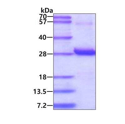 SDS-Page: Recombinant Human Proteasome beta 1 His Protein [NBP1-37087] - 3ug by SDS-PAGE under reducing condition and visualized by coomassie blue stain.