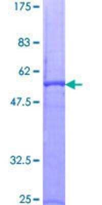 SDS-Page: Recombinant Human Proteinase 3/Myeloblastin/PRTN3 Protein [H00005657-P01] - 12.5% SDS-PAGE stained with Coomassie Blue.