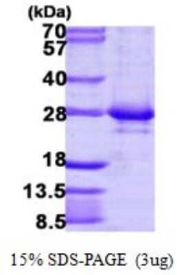 SDS-PAGE Recombinant Human RAB14 His Protein