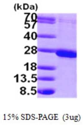 SDS-PAGE Recombinant Human RAB1B His Protein