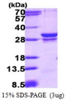 SDS-Page: Recombinant Human RAB23 Protein [NBP1-72529] - 15% SDS-PAGE (3ug)