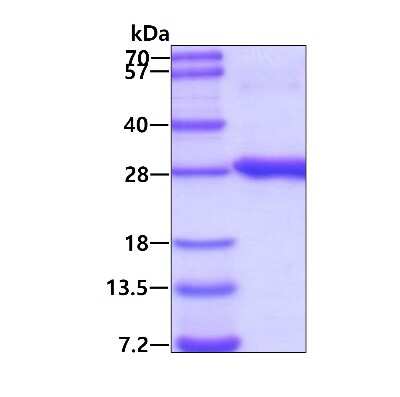 SDS-Page: Recombinant Human RAB2B His Protein [NBP1-78858] - 3ug by SDS-PAGE under reducing condition and visualized by coomassie blue stain.