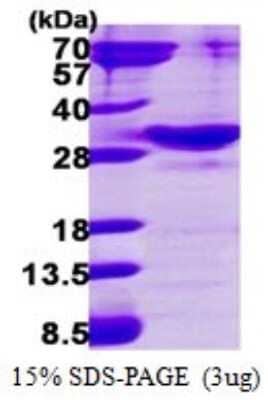 SDS-Page: Recombinant Human RAB34 Protein [NBP1-72530] - 15% SDS-PAGE (3ug)