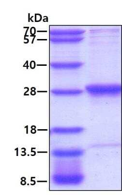 SDS-PAGE Recombinant Human RAB3B His Protein