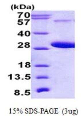 SDS-PAGE Recombinant Human RAB5C His Protein