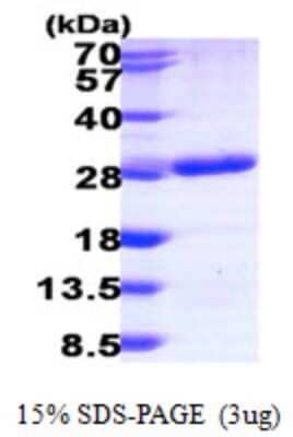 SDS-Page: Recombinant Human RAB6B Protein [NBP1-50995] - 15 % SDS-PAGE (3ug)