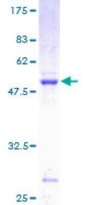 Unknown Recombinant Human RAB7L1 GST (N-Term) Protein