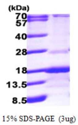 SDS-PAGE Recombinant Human RABIF/MSS4 His Protein
