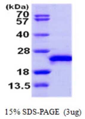 SDS-Page: Recombinant Human RAC3 Protein [NBP1-50927] - 15 % SDS-PAGE (3ug)