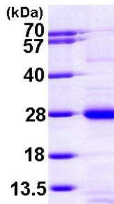 SDS-PAGE Recombinant Human RAP1A His Protein