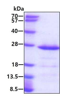 SDS-PAGE Recombinant Human RAP1B His Protein