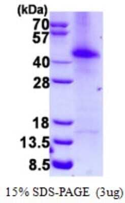 SDS-PAGE Recombinant Human RAP30 His Protein