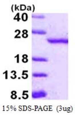 SDS-Page: Recombinant Human RBBP9 Protein [NBP1-72549] - 15% SDS-PAGE (3ug)