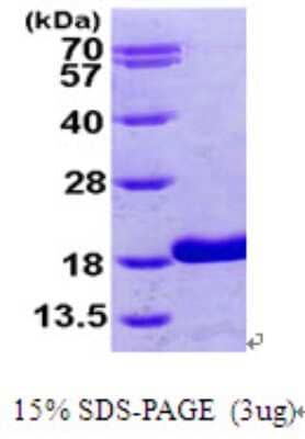 SDS-PAGE Recombinant Human RBP5 His Protein