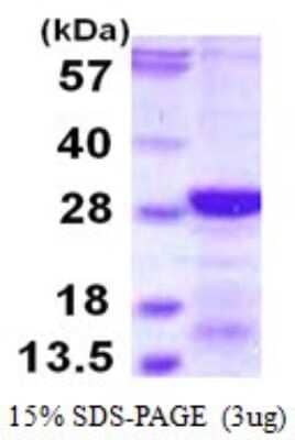 SDS-PAGE Recombinant Human RCAN2 His Protein