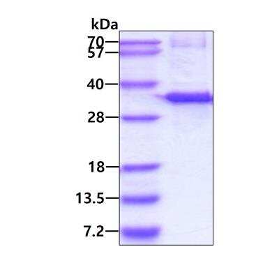 SDS-PAGE Recombinant Human RDH12 His Protein