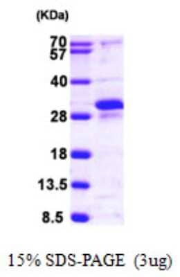 SDS-Page: Recombinant Human RERG Protein [NBP1-50998] - 15 % SDS-PAGE (3ug)