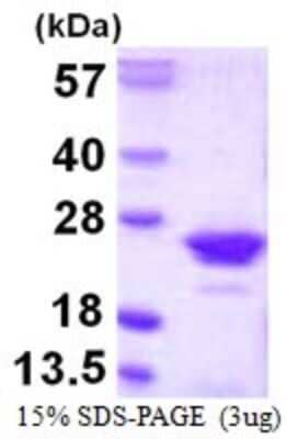 SDS-Page: Recombinant Human RGS10 Protein [NBP1-72389] - 15% SDS-PAGE (3ug)