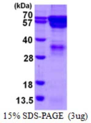 SDS-Page: Recombinant Human RGS14 Protein [NBP1-98906] - 15% SDS-PAGE (3ug)