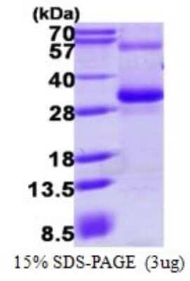 SDS-PAGE Recombinant Human RGS17 His Protein