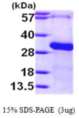 SDS-Page: Recombinant Human RGS19 Protein [NBP1-50894] - 15 % SDS-PAGE (3ug)