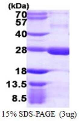 SDS-Page: Recombinant Human RGS5 Protein [NBP1-72414] - 15% SDS-PAGE (3ug)