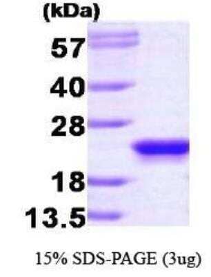 SDS-Page: Recombinant Human RKIP/PBP Protein [NBP1-30224] -  PEBP1, 21 kDa (187aa), confirmed by MALDI-TOF with a purity of 95% by SDS - PAGE