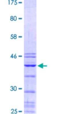 SDS-Page: Recombinant Human RNA polymerase I termination factor Protein [H00007270-Q01] - 12.5% SDS-PAGE Stained with Coomassie Blue.