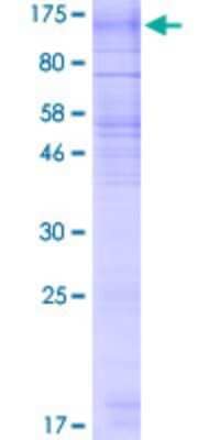 SDS-Page: Recombinant Human RNF139 Protein [H00011236-P01] - 12.5% SDS-PAGE Stained with Coomassie Blue.