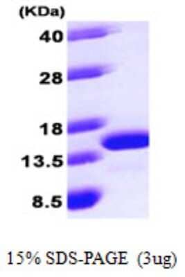 SDS-Page: Recombinant Human ROBLD3 Protein [NBP1-50918] - 15 % SDS-PAGE (3ug)