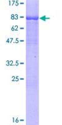 SDS-Page: Recombinant Human ROR gamma/RORC/NR1F3 Protein [H00006097-P01] - 12.5% SDS-PAGE Stained with Coomassie Blue.