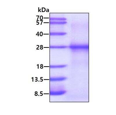 SDS-Page: Recombinant Human RPE Protein [NBP1-99080] - 3ug by SDS-PAGE under reducing condition and visualized by coomassie blue stain.