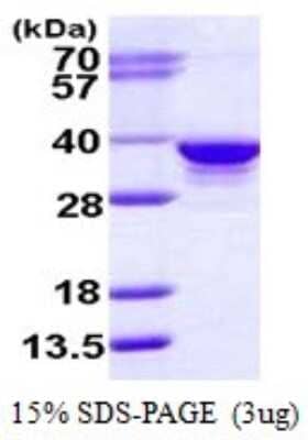 SDS-Page: Recombinant Human RPIA Protein [NBP1-78855] - 15% SDS-PAGE (3ug)