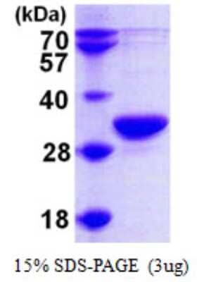 SDS-PAGE Recombinant Human RPP30 His Protein