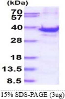 SDS-PAGE Recombinant Human RPS3A His Protein