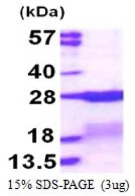 SDS-Page: Recombinant Human RPS7 Protein [NBP1-72552] - 15% SDS-PAGE (3ug)