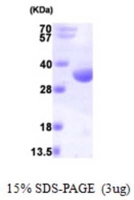 SDS-PAGE Recombinant Human RQCD1 His Protein