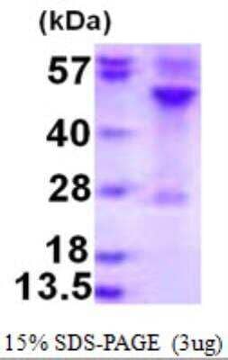 SDS-PAGE Recombinant Human RRAGC His Protein