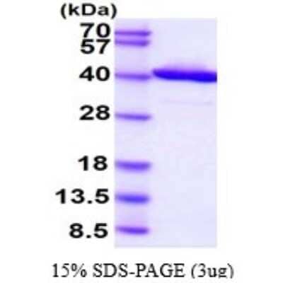 SDS-Page: Recombinant Human RTN4IP1 Protein [NBP1-78859] - 15% SDS-PAGE (3ug)