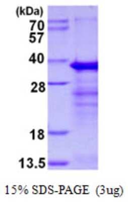 SDS-Page: Recombinant Human RYBP/DEDAF Protein [NBP1-98929] - 15% SDS-PAGE (3ug)