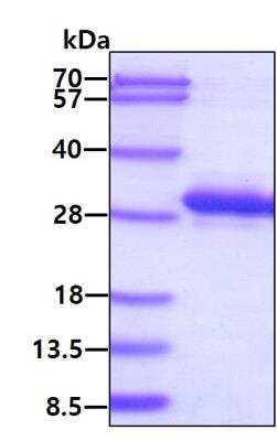 SDS-PAGE Recombinant Human Rab11A His Protein