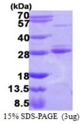 SDS-PAGE Recombinant Human Rab17 His Protein