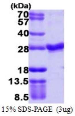 SDS-Page: Recombinant Human Rab4 Protein [NBP1-72350] - 15% SDS-PAGE (3ug)