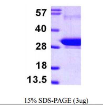 Recombinant Human Rab5b Protein [NBP1-50930]