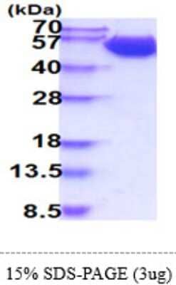 SDS-PAGE Recombinant Human CD98 His Protein