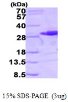 SDS-Page: Recombinant Human RalB Protein [NBP1-50923] - 15 % SDS-PAGE (3ug)