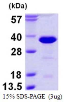 SDS-Page: Recombinant Human RanBP1 Protein [NBP1-99058] - 15% SDS-PAGE (3ug)