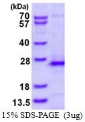 SDS-PAGE Recombinant Human RhoG His Protein