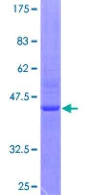 SDS-Page: Recombinant Human RhoH Protein [H00000399-P01] - 12.5% SDS-PAGE Stained with Coomassie Blue.